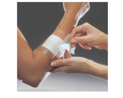 FILM ADESIVO IN POLIURETANO IN ROTOLO TRASPARENTE IMPERMEABILE PER FISSAGGIO DI MEDICAZIONI E CATETERI 10X1000CM 1 PEZZO - latuafarmacia.org